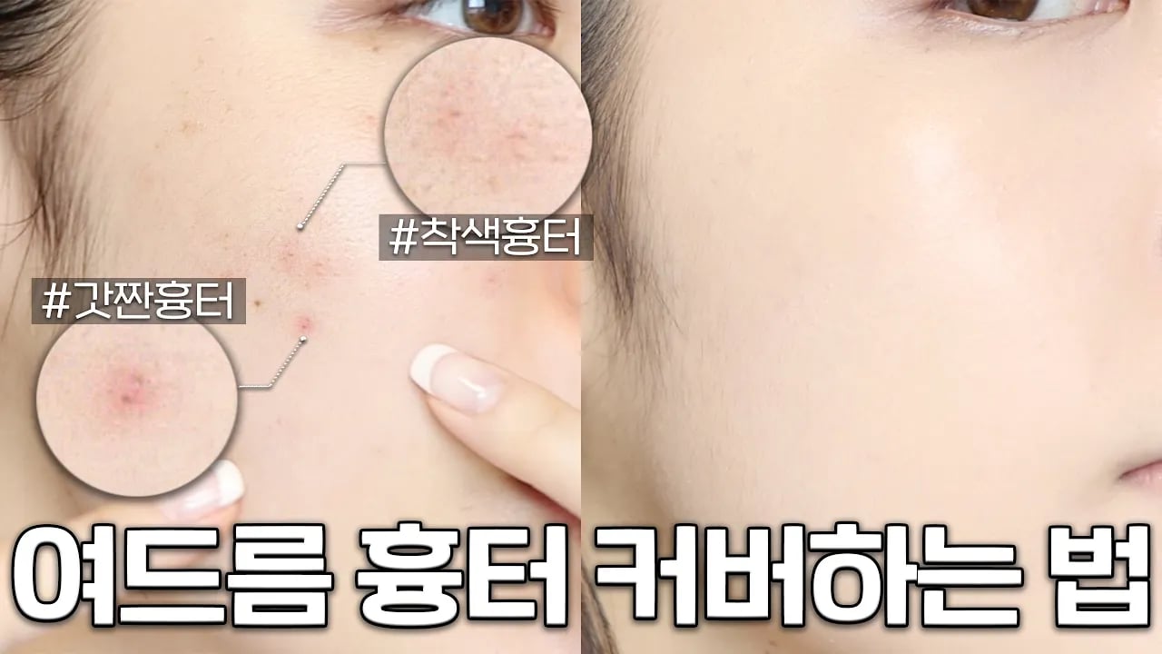 보정❌ 여드름 흉터 커버하는 방법‼️트러블 올라온 날도 깨끗한 피부 ( 트러블/색소침착/잡티 피부 커버 방법 ) + 문의 100건 컨실러 브러쉬 추천까지✨