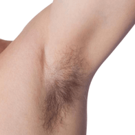 科技新突破：怎麼用腋毛植髮？