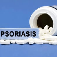 Plaque Psoriasis: Common Symptoms and Treatment Options