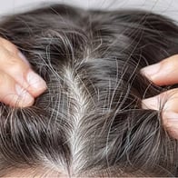 What Plaque Psoriasis Looks Like And Treatment Options