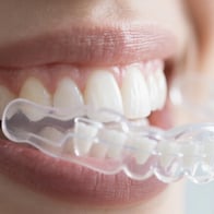 東京 AO 入試に向けて、塾の実践的な学習方法を大公開