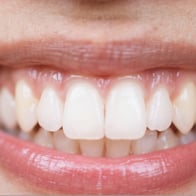 輝く笑顔！美容歯科クリニックのホワイトニング技術で、あなたも注目のスターに✨