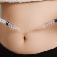 無痛、非侵襲的、副作用なし - 脂肪溶解注射とはなにか