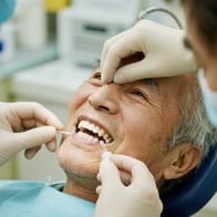 高齢者でも安心のインプラント治療―費用や手術の流れを徹底解説