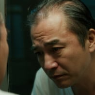 日本中高年層向けの植毛ガイド：成功するための知識と注意点