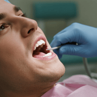 🦷 Implantes Dentales Económicos en España: Guía Completa para Ahorrar sin Perder Calidad
