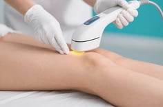 How Much Does Laser Hair Removal Surgery Cost in 2025?