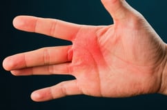 手指の痛み・しびれを改善！専門医が教える自宅でできるセルフケア法ン