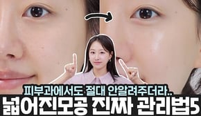 모공넓어지는 찐이유 따로있다⁉️제발 피부과가지말고 5가지만 지키세요‼️ㅣ피부관리,모공케어,가로모공,세로모공 관리루틴꿀팁ㅣ 인보라INBORA