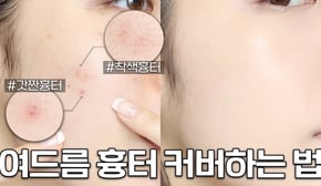 보정❌ 여드름 흉터 커버하는 방법‼️트러블 올라온 날도 깨끗한 피부 ( 트러블/색소침착/잡티 피부 커버 방법 ) + 문의 100건 컨실러 브러쉬 추천까지✨
