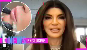The Real Reason RHONJ’s Teresa Giudice Dissolved Her Lip Fillers (Exclusive) | E! News