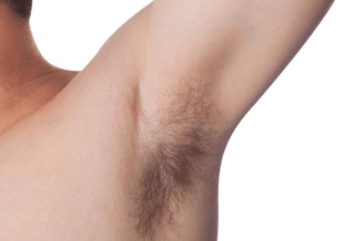 科技新突破：怎麼用腋毛植髮？