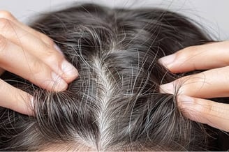 What Plaque Psoriasis Looks Like And Treatment Options