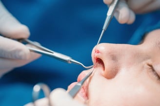 鼻整形で印象アップ!人気の手術方法とは?