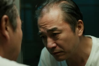 日本中高年層向けの植毛ガイド：成功するための知識と注意点