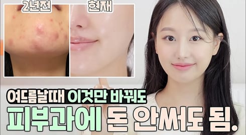 ํผ๋ถ๊ณผ๋๋ญ๋น ๊ทธ๋งโ์ ๋ฐ ๋ฐ๋ผ๋งํด..10๋
๊ณ ์ํ ์ฑ์ธ์ฌ๋๋ฆ ์์ ๋ ๋ฐฉ๋ฒ(ft.ํผ๋ถ์ข์์ง๋๋ฐฉ๋ฒ,ํผ๋ถ๋๋น ์ง๋์ต๊ด,์ฌ๋๋ฆ์์ ๋๋ฒ๋ฑ)ใ
ฃ์ธ๋ณด๋ผINBORA