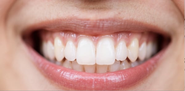 輝く笑顔!美容歯科クリニックのホワイトニング技術で、あなたも注目のスターに✨