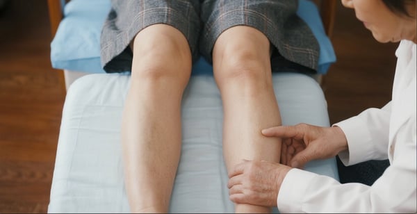 脚の血管ボコボコが消える!?費用も抑えられる静脈瘤治療ガイド