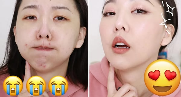 大爆痘也能妝出完美膚質 長痘痘到底該怎麼化妝?