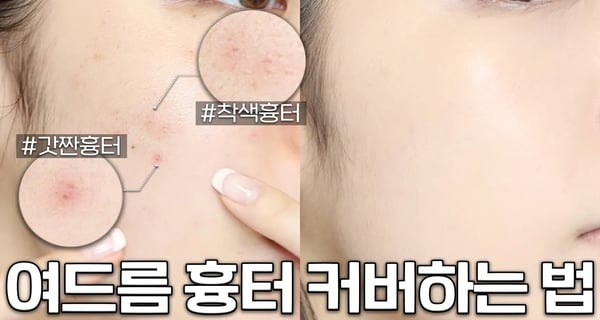 보정❌ 여드름 흉터 커버하는 방법‼️트러블 올라온 날도 깨끗한 피부 ( 트러블/색소침착/잡티 피부 커버 방법 ) + 문의 100건 컨실러 브러쉬 추천까지✨