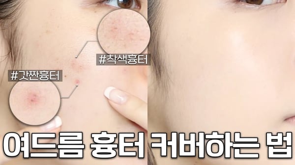 보정❌ 여드름 흉터 커버하는 방법‼️트러블 올라온 날도 깨끗한 피부 ( 트러블/색소침착/잡티 피부 커버 방법 ) + 문의 100건 컨실러 브러쉬 추천까지✨