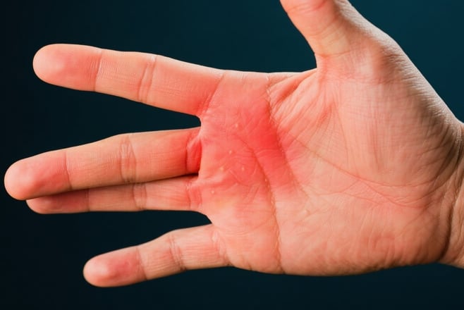 手指の痛み・しびれを改善!専門医が教える自宅でできるセルフケア法ン