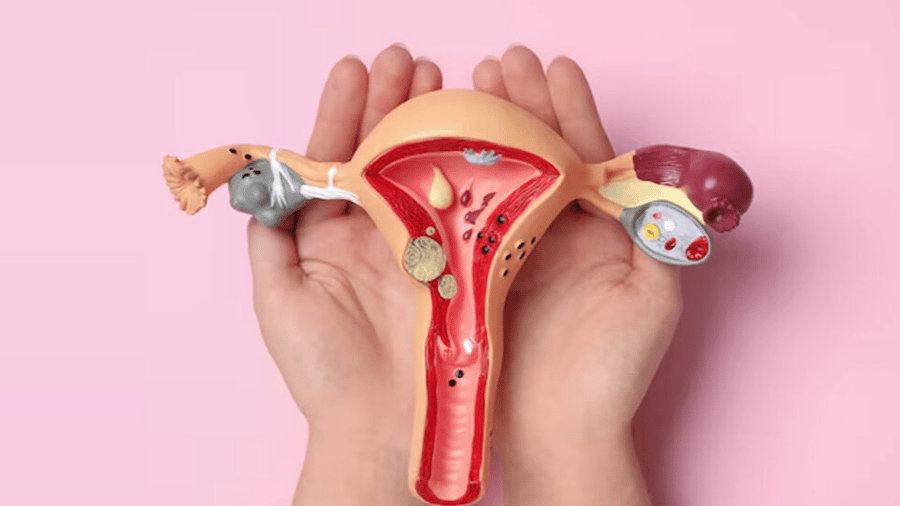 Essential Tips for Maintaining Vaginal Health: Guide to Comfort and Wellness in 2025